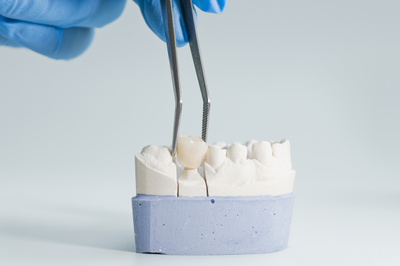 Prótese Dentária